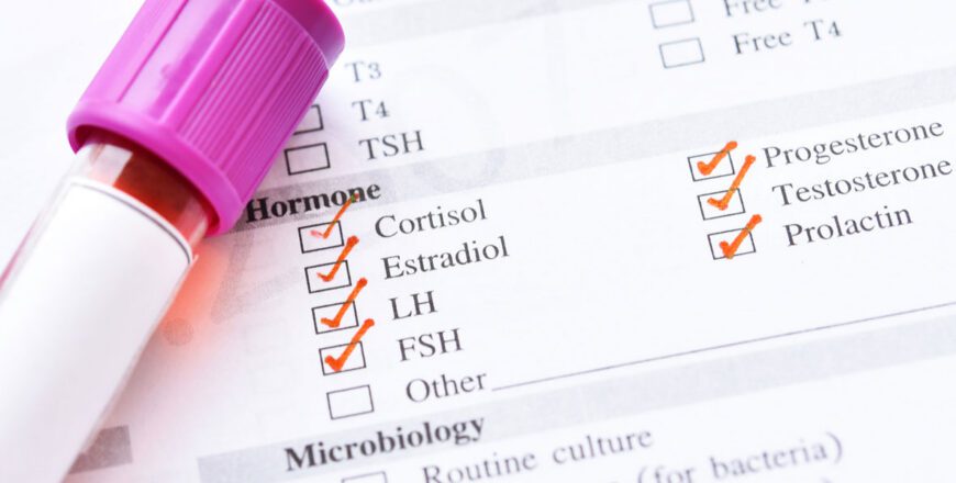 blood-sample-tube-resting-on-a-lab-request-form-with-hormone-tests-checked-off